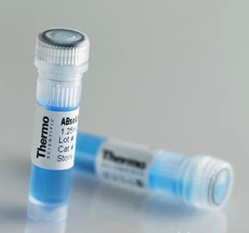 DC12 Antibody (C-term) 货号：AP10997b